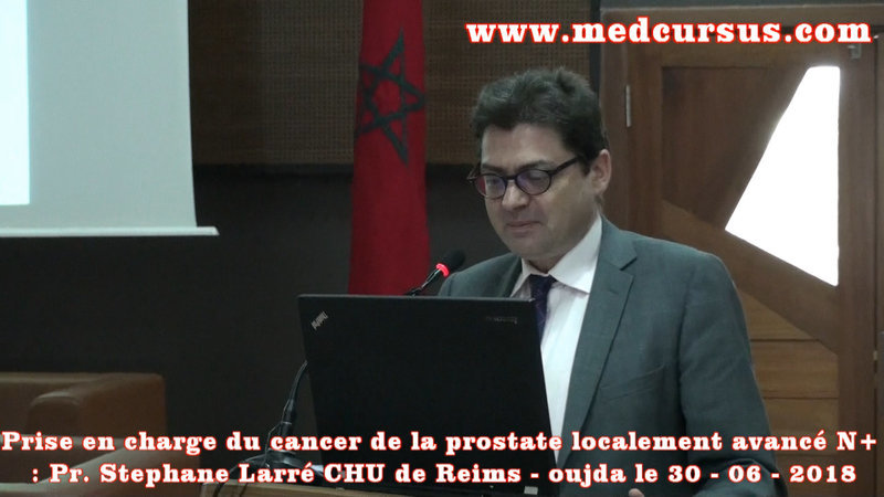 Pr. Stéphane Larré : Prise en charge du cancer de la prostate localement avancé N+ VIDEO